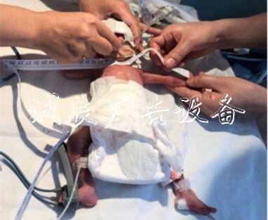 汕頭超早產(chǎn)3胞胎“手掌宣傳欄寶寶”出院 出生不足兩斤