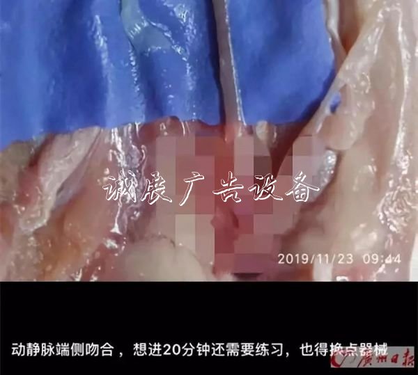 他每天都來買雞鴨翅，滾動燈箱但只買一個！真相讓網(wǎng)友